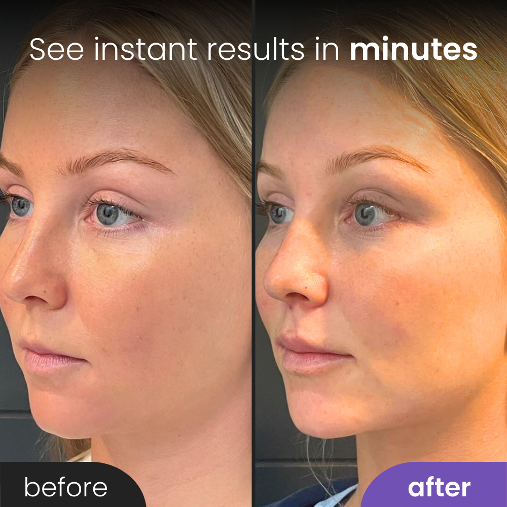 Refine ™ Beauty Sculptor