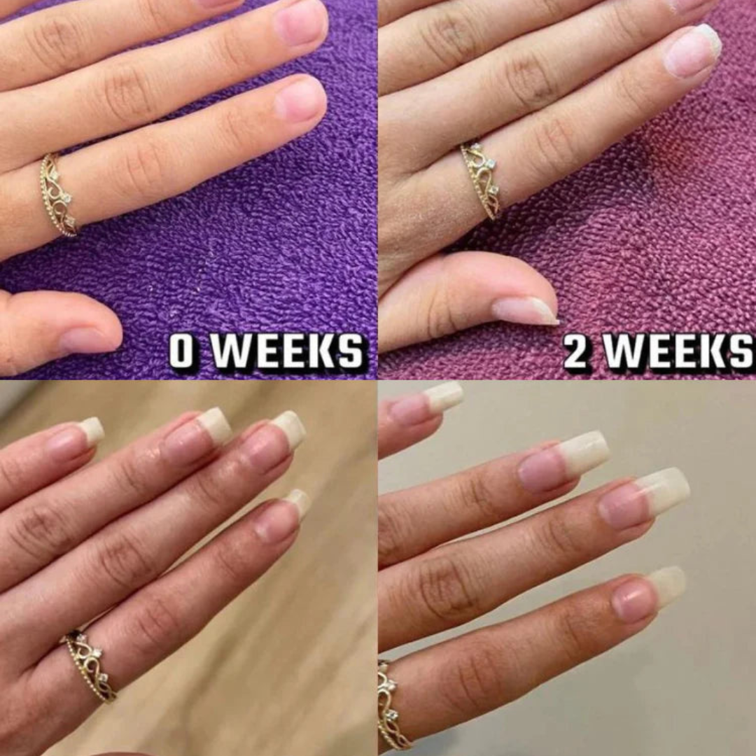 Stylo de croissance des ongles Nayassa™ 