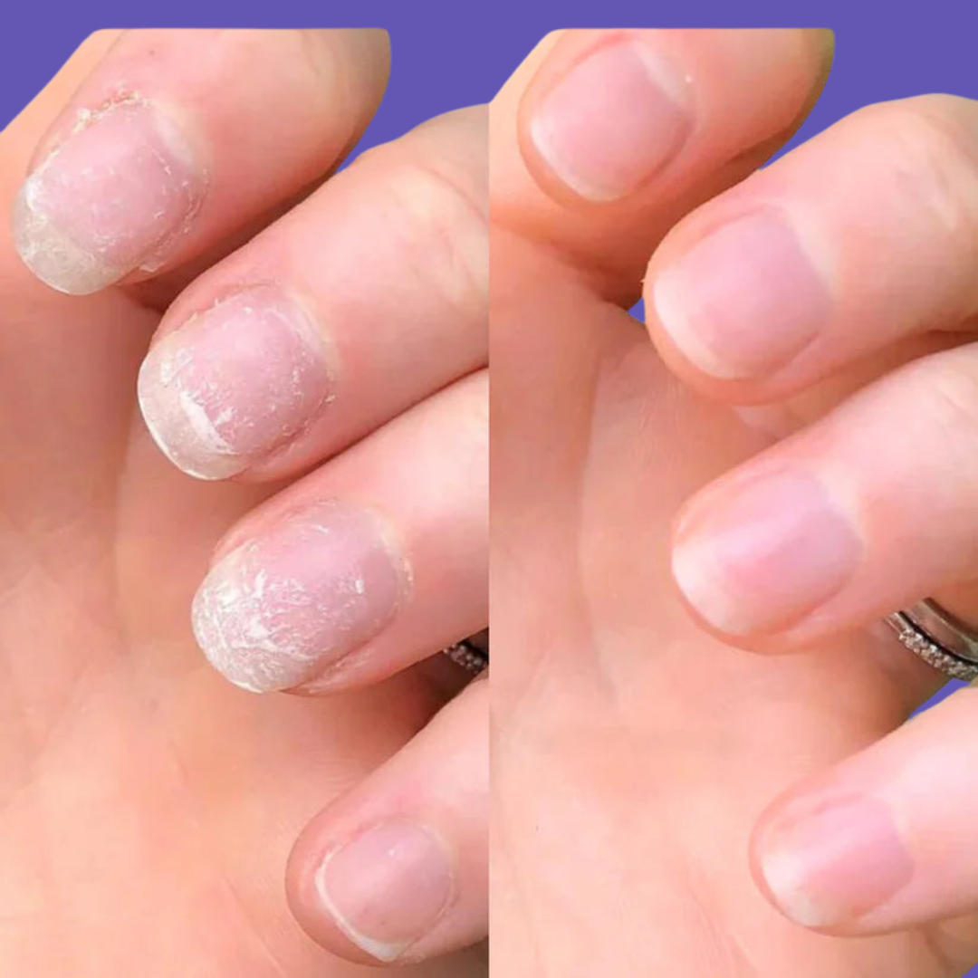 Stylo de croissance des ongles Nayassa™ 