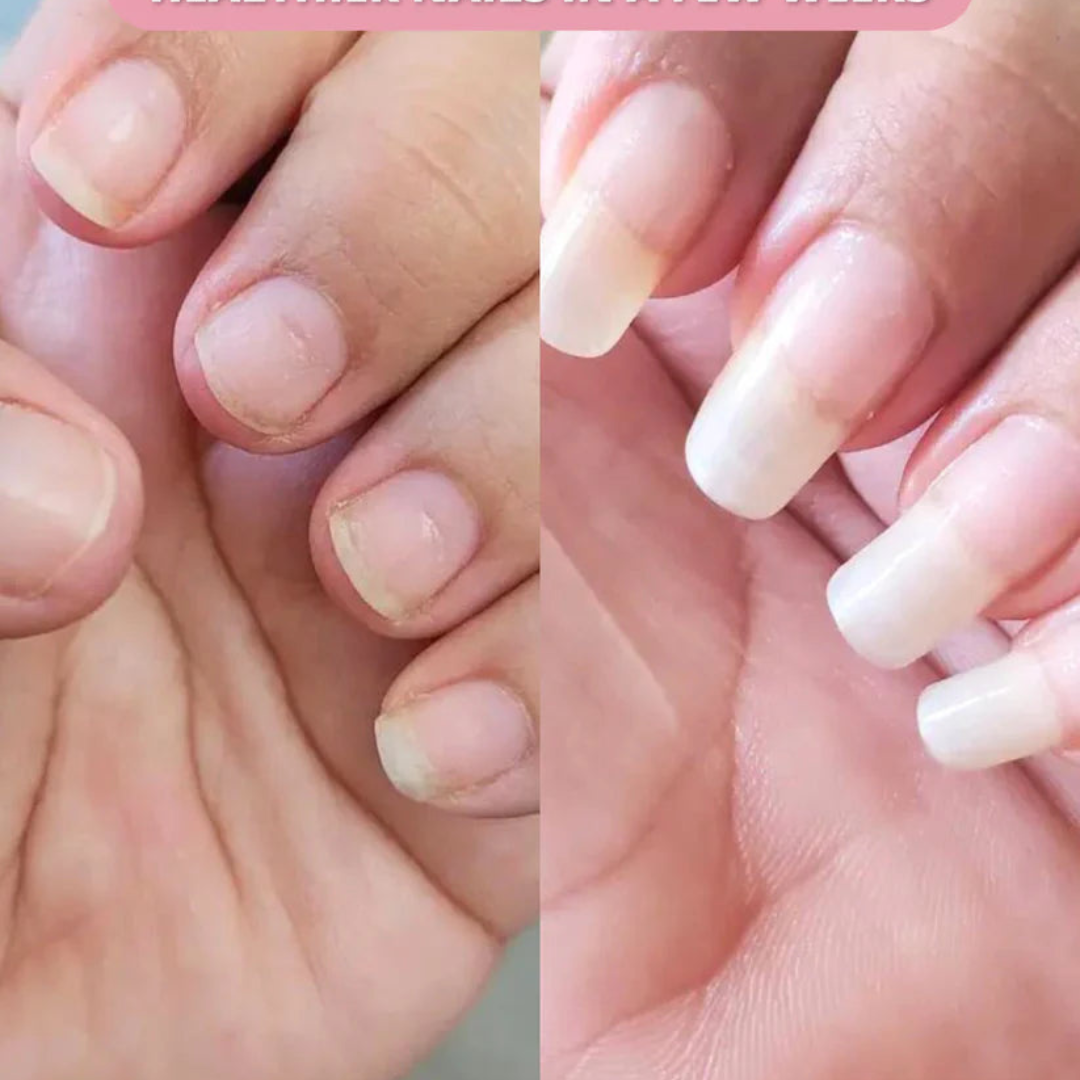 Stylo de croissance des ongles Nayassa™ 
